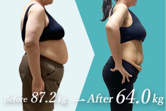 12ヵ月で23キロ痩せた女性の画像